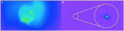 Large Spectral Shift of Reflected Radiation From Laser Plasmas Generated by High Contrast KrF Laser Pulses